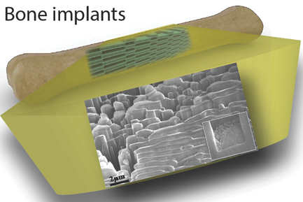 3D Porous Graphene by Low-Temperature Plasma Welding for Bone Implants